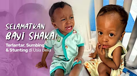 Tolong Bayi Shaka! Gizi Buruk Tunda Operasi